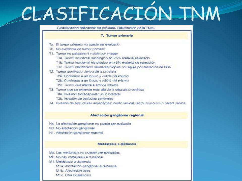 carcinoma de prostata clasificaciones